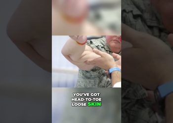 1000-lb Sisters: Tammy Slaton's Huge Weight Loss Gives Her Loose Skin #TammySlaton #1000lbsisters