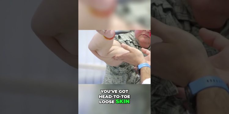 1000-lb Sisters: Tammy Slaton's Huge Weight Loss Gives Her Loose Skin #TammySlaton #1000lbsisters