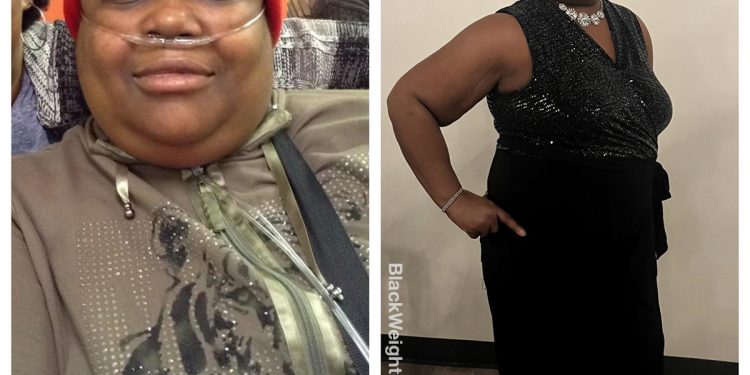 Angela lost 93 pounds – Black Weight Loss Success