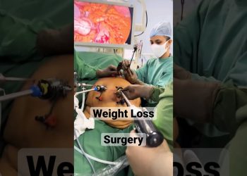 How we do WEIGHT LOSS TREATMENT ? Bariatric Surgery ? Fat removal
