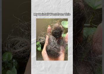 Amla Ginger Detox Shots for Hairfall & Healthy Skin | Detox Drink #detoxdrink
