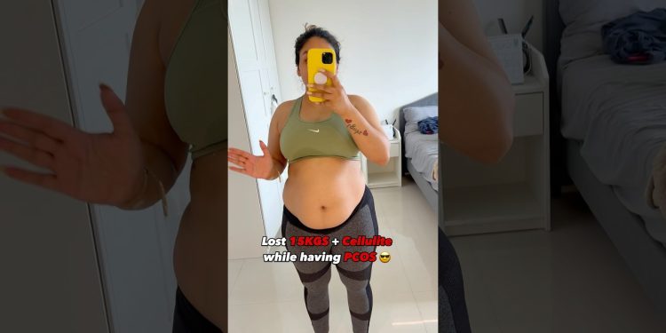 Lost 15kgs weight and cellulite despite having PCOS 🧿✨ #pcos #weightloss #weightlossjourney #shorts
