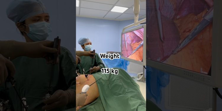 Fastest Weight Loss I Obesity Surgery I Fat Removal Operation I India I Gujarat