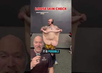 Loose Skin After Massive Weight Loss