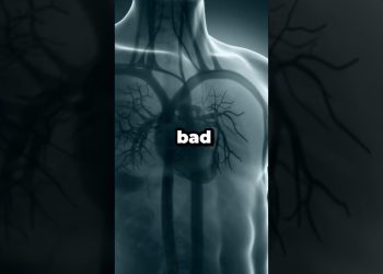 Bad Foods To Avoid #health #wellness #diet #nutrition