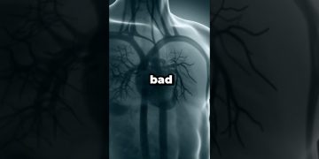 Bad Foods To Avoid #health #wellness #diet #nutrition