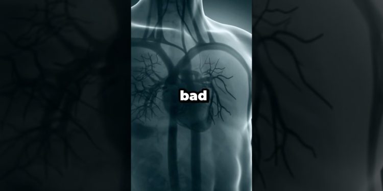 Bad Foods To Avoid #health #wellness #diet #nutrition