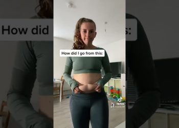 Extreme Weightloss Transformation!!😱 #fatloss #weightloss