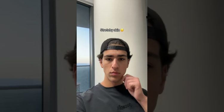 Weird things that happen after losing weight #weightloss